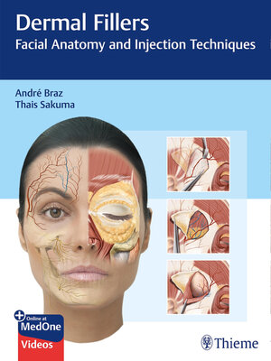 cover image of Dermal Fillers